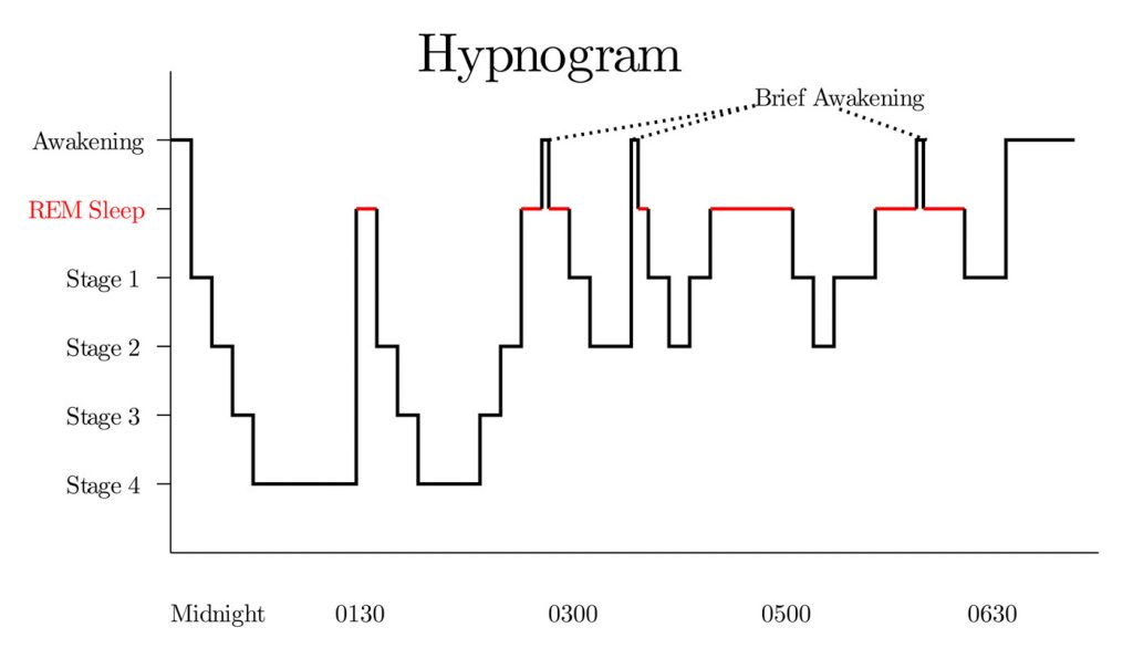 sleep stages hypnogram